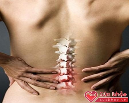 Các bệnh về xương khớp là nguyên nhân gai cột sống lưnga