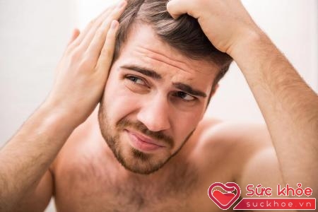 Triệu chứng rụng tóc ở nam giới biểu hiện rõ ở tuổi trung niên