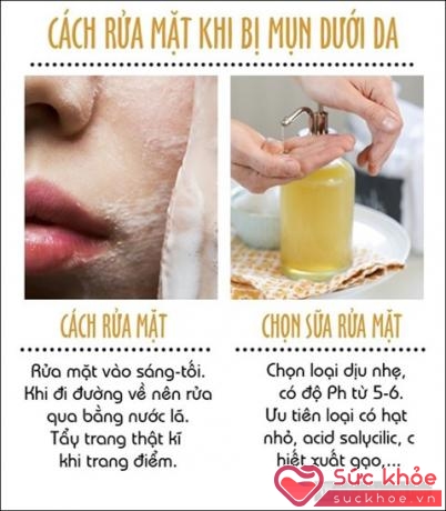 Cách rửa mặt khi bị mụn dưới da