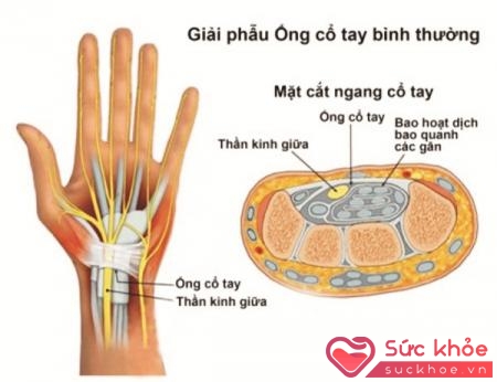 Khi thấ tay đau tê là dấu hiệu bạn đã mắc phải hội chứng này