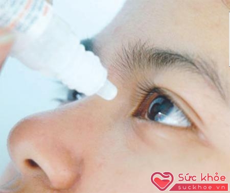 Điều trị tăng nhãn áp bằng thuốc nhỏ mắt hoặc phẫu thuật