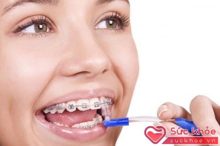 Cao răng được hình thành từ mảng bám răng