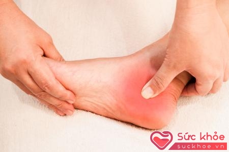 Bệnh gai gót chân do ở xương gót chân có hiện tượng bù đắp canxi dần dần tại những nơi có vi chấn thương trên xương gót