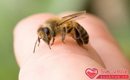 Nọc ong làm giảm mạnh sự sưng tấy mô và hình thành gai xương