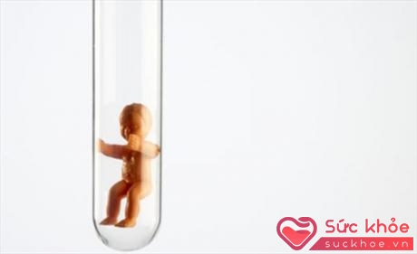 Thụ tinh trong ống nghiệm (IVF) là thủ thuật dành cho hàng ngàn phụ nữ không thể sinh con một cách tự nhiên