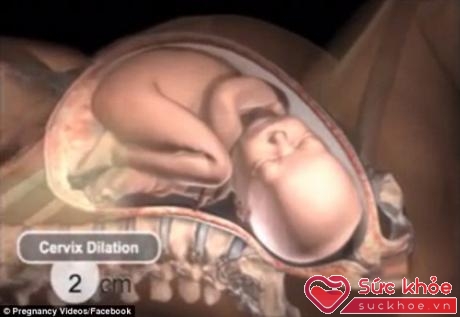 Cơ thể phụ nữ sẽ đáp ứng theo sự giãn nở của xương chậu trong quá trình em bé chào đời.