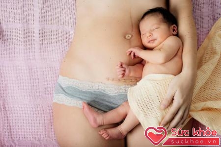 Thủ thuật sinh mổ thường được thực hiện nếu sinh qua đường âm đạo được cho là quá nguy hiểm.