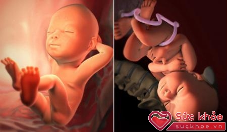 Vào tuần thai thứ 20, qua hình ảnh siêu âm mẹ sẽ nhìn thấy rõ ràng hình ảnh đầy đủ của thai nhi giống như một em bé ngoài đời