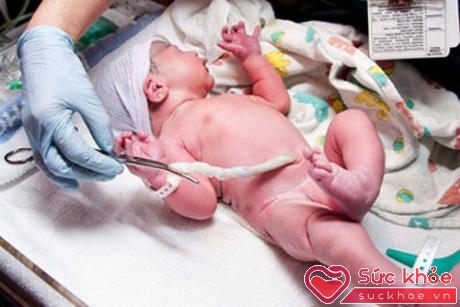 Dây rốn quấn quanh người bé, nếu dây quá ngắn có thể bị căng quá mức hoặc co thắt lại, làm cắt đứt hoặc giảm sự trao đổi chất giữa mẹ và thai nhi