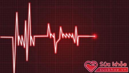 goại tâm thu thất là một trong các rối loạn nhịp tim thường gặp nhất
