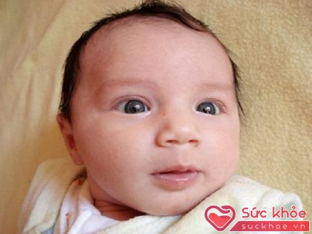 Trẻ từ sơ sinh đến 5 tháng tuổi thường dễ dàng mắc các triệu chứng lác bởi thời gian này mắt bé chưa được phát triển toàn diện