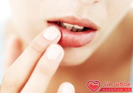 Những vết nứt nhỏ khô rát khó chịu ở môi, đặc biệt khoé môi là dấu hiệu chứng tỏ bạn đang thiếu Vitamin B, đặc biệt là B6