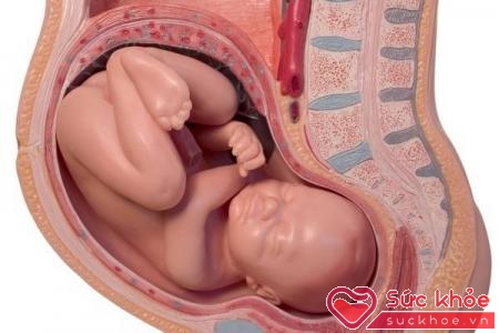 Suy thai là tình trạng thai nhi bị thiếu oxy trong thai kỳ hoặc trong quá trình chuyển dạ