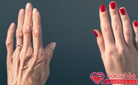 Bàn tay cũng là nơi “tố cáo” tuổi tác khó che giấu
