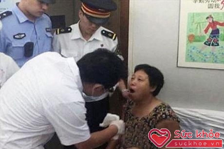 Các bác sĩ cố định lại hàm cho bà Jiao Chiu