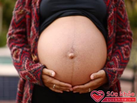 Đường sọc màu nâu xuất hiện ở bụng dưới trong quá trình mang thai là hiện tượng bình thường