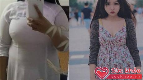 Minh Anh trước và sau giảm cân