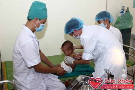 ​Điều trị bỏng cho trẻ em tại BV Nhi Hải Dương.