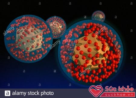 Herpes simples virút (HSV)