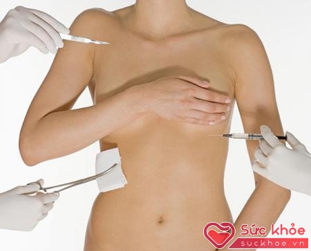Phẫu thuật thu nhỏ ngực cần được thực hiện trong môi trường bệnh viện