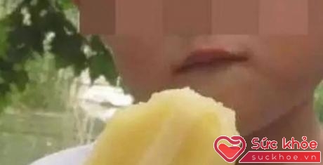 Cậu bé 7 tuổi ở tỉnh An Huy, Trung Quốc đã rơi vào tình trạng "thập tử nhất sinh" chỉ vì ăn 3 que kem liền một lúc!