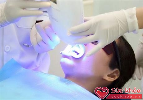 Tẩy trắng răng bằng laser, lợi và mô mềm được cách ly và bảo vệ kỹ lưỡng.