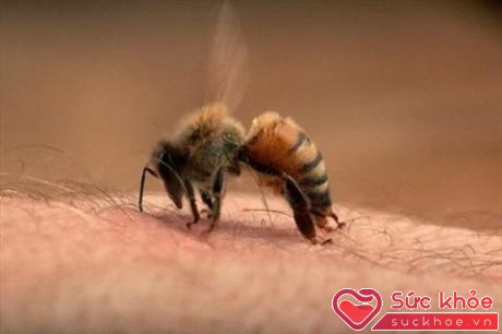Vết ong đốt càng để lâu càng thấm sâu vào máu và gây nhức nhối, khó chịu nhiều hơn.