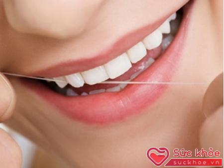 Nên thường xuyên chải răng bằng chỉ nha khoa.