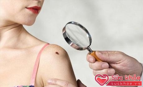 Tia cực tím gây tổn hại bề mặt lớp biểu bì của da, khiến da bị bỏng nắng, kích thích hắc tố, làm biến màu da và thậm chí là ung thư da