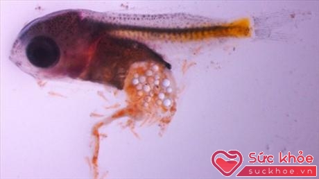 Một ấu trùng cá trinh nữ chứa rất nhiều hạt vi nhựa.