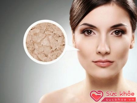 Da mặt khô sần chứng tỏ bạn đang sở hữu làn da không khỏe