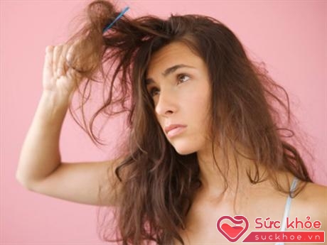Thiếu dưỡng chất là một trong những nguyên nhân gây rụng tóc