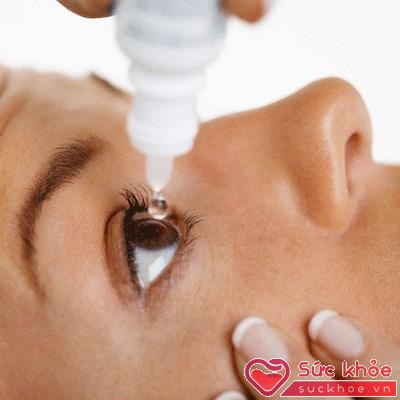 Khi mắt bị khô nên sử dụng các dung dịch bôi trơn mắt để bồi phụ lượng nước mắt bị thiếu hụt.
