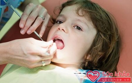 Bộ răng sữa có vai trò quan trọng trong quá trình phát triển thể chất và tâm lý của trẻ