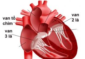 Nguyên nhân và triệu chứng thường gặp của bệnh suy tim phải