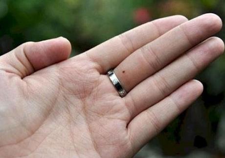 Phụ nữ có nốt ruồi trên ngón tay nào số giàu sang vượng phu ích tử?