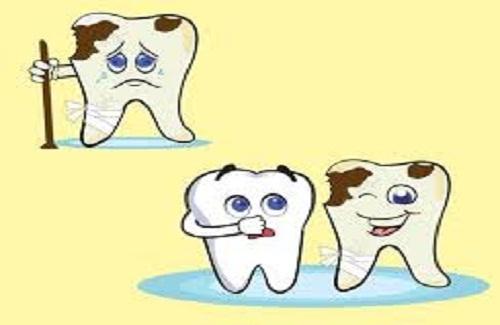 Bệnh viêm tủy răng - Nguyên nhân và cách điều trị