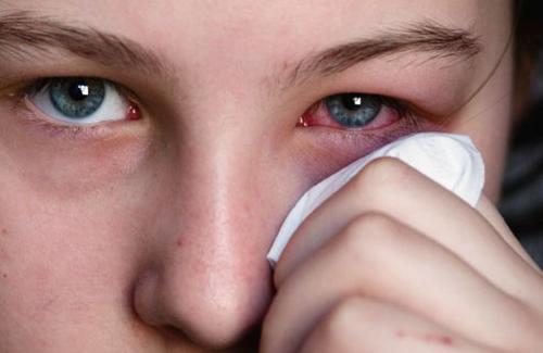 Biểu hiện, triệu chứng đau mắt hột dễ nhận biết nhất