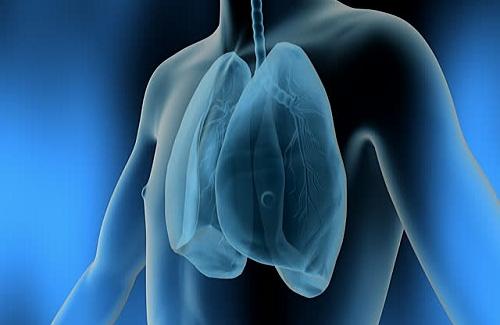Bệnh áp-xe phổi và nguyên nhân gây bệnh áp-xe phổi