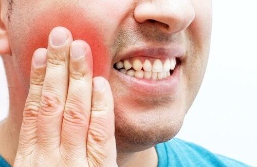 Mách bạn 10 cách chữa đau răng nhanh nhất tại nhà không cần dùng thuốc