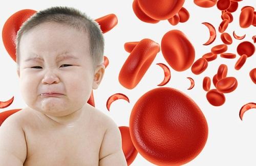 Bệnh thiếu máu ở trẻ em - Nguyên nhân và cách điều trị
