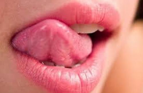 Bệnh sùi mào gà ở miệng có những biểu hiện như thế nào?