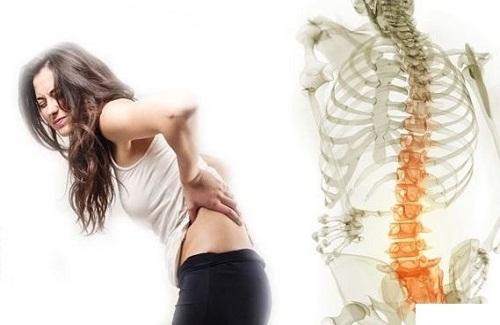 Chứng đau lưng do thoái hóa cột sống bạn đã thực sự biết chưa?