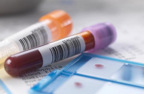 Chỉ số huyết học - Cách đọc thông tin xét nghiệm máu