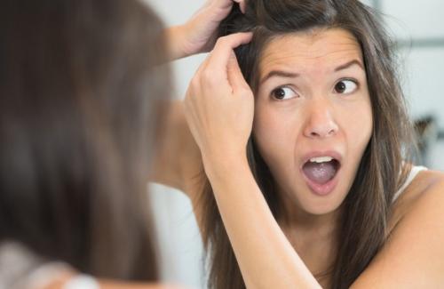 Nguyên nhân và cách điều trị tóc bạc sớm ở thanh niên