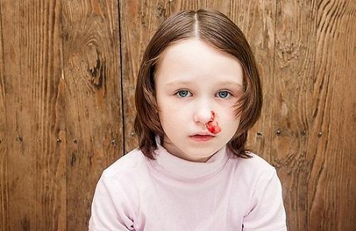Những nguyên nhân chảy máu cam ở trẻ em có thể bạn chưa biểt