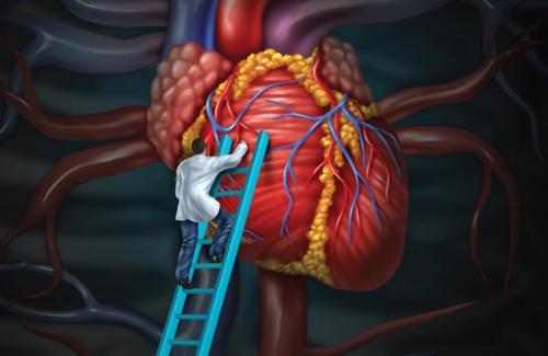 Các triệu chứng u tim biểu hiện qua từng dạng bệnh