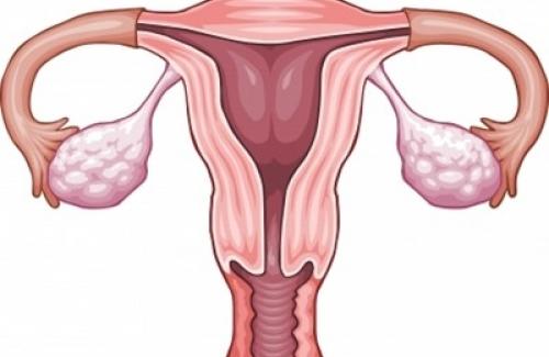 Bệnh đa nang buồng trứng – Một số những thông tin chị em cần biết rõ