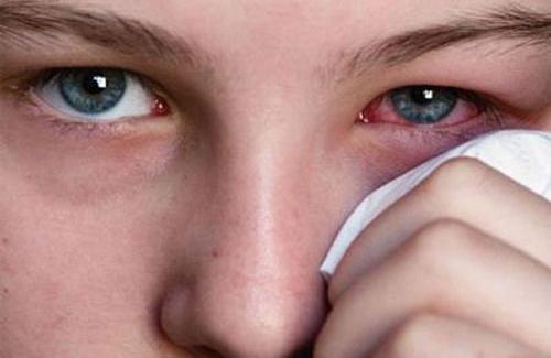 Cùng tìm hiểu về các loại đau mắt phổ biến hiện nay