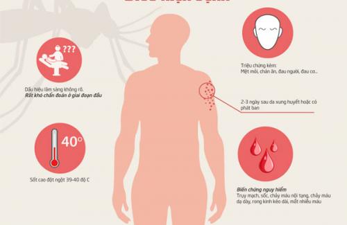 Năm triệu chứng của bệnh sốt xuất huyết và tiến trình phát triển của bệnh